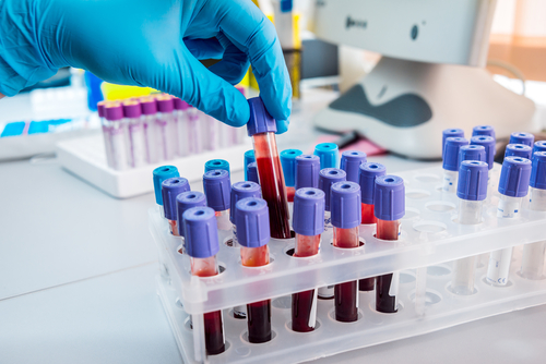Blood testing